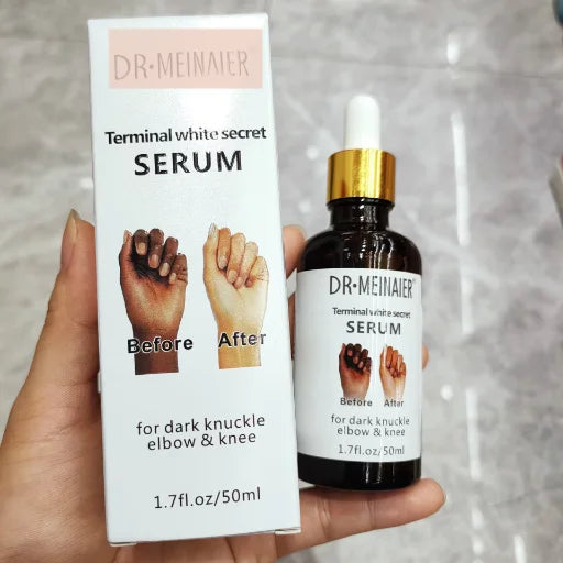 Dark Knuckles Remover Fast Whitening Serum 7days Bleaching Hand Elbow Knee & Dark Spot And Black Skin Corrector - Buy Product on Alibaba.com